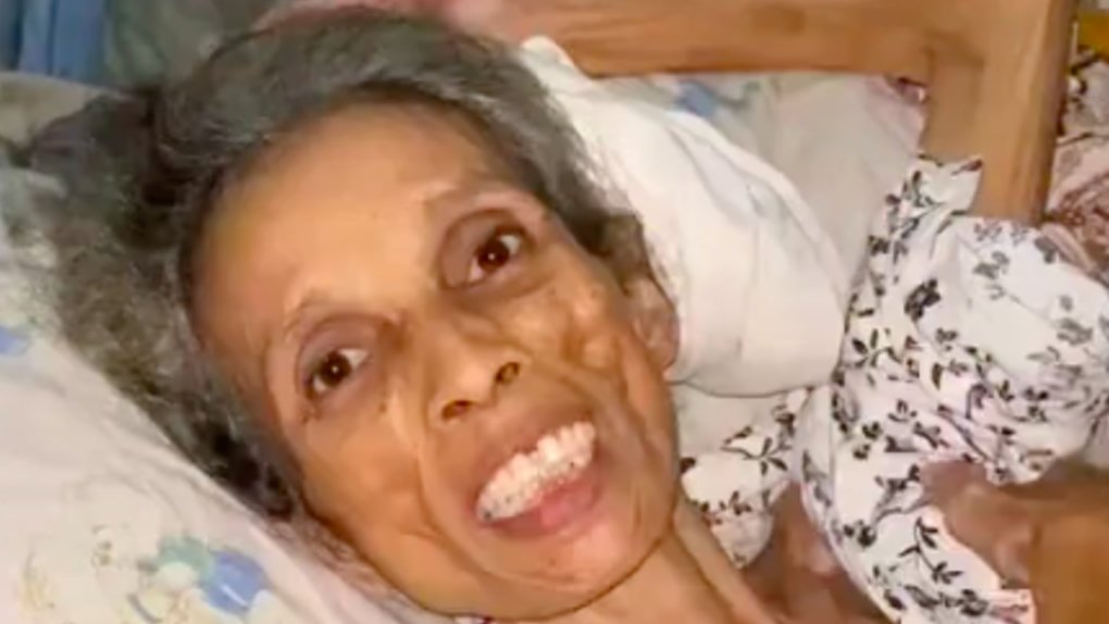 Kartinah, warga Parung Bogor yang tengah berjuang melawan penyakit.